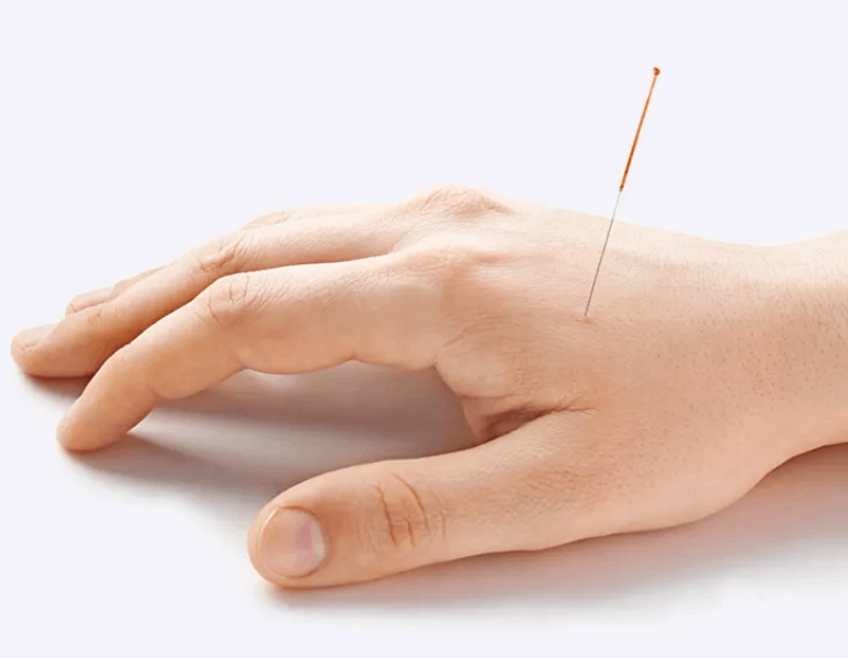AMS Acupuncture