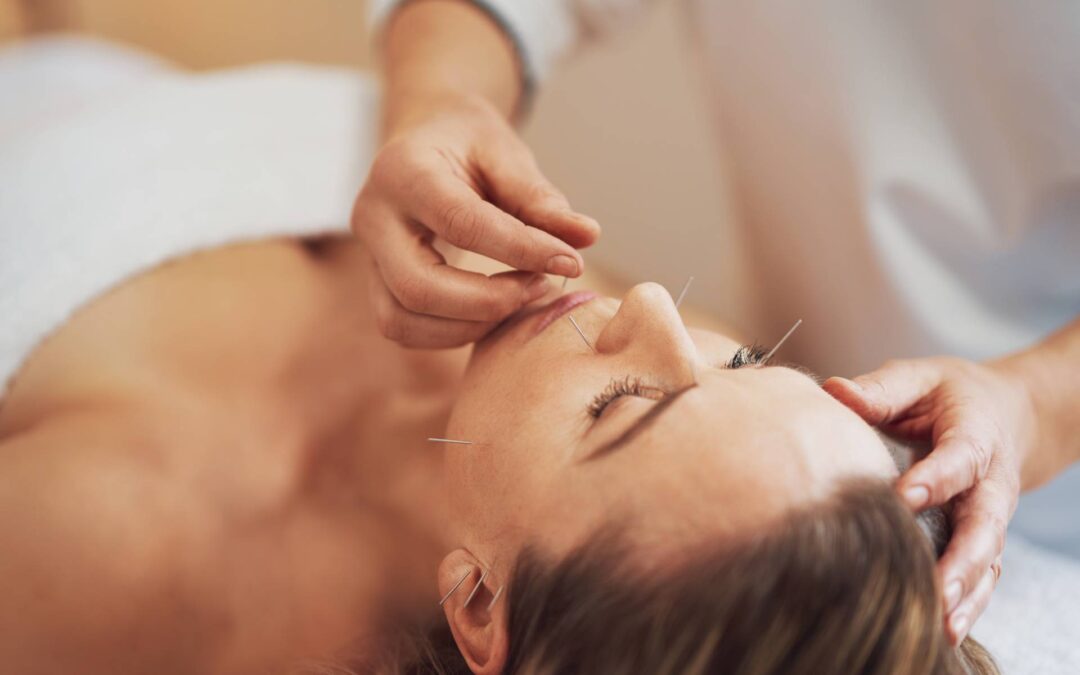 Acupuncture : Un soulagement possible pour les patients atteints de paralysie de Bell